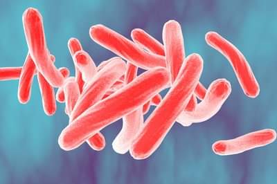Tuberculosis (TB)