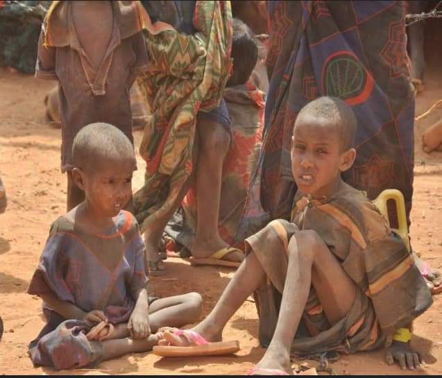 Malnutrition