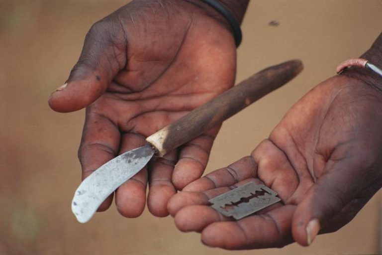 Female Genital Mutilation (FGM)