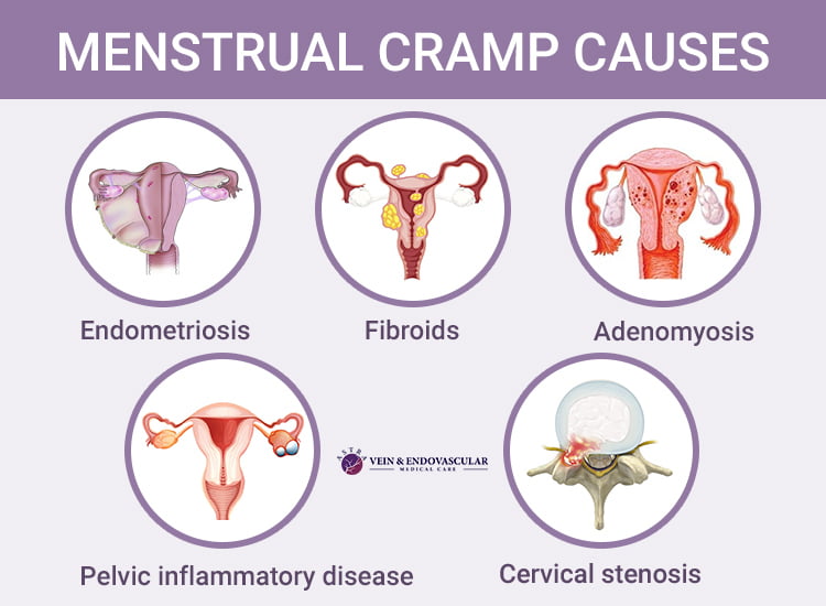 Menstrual Cramps