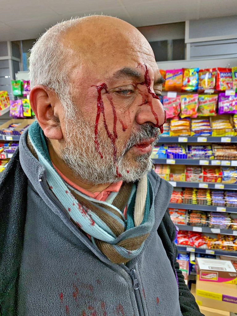 Photo 1 Jimmy Morar, diaspora shopkeeper moments after the vicious attack in his store in Liverpool, UK