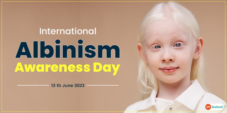 Embracing Humanity In Albinism.